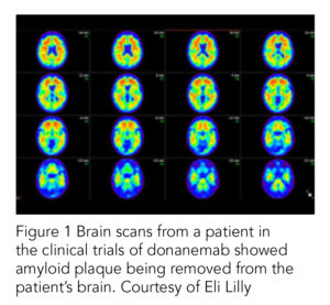 Brain Scan - Waveny